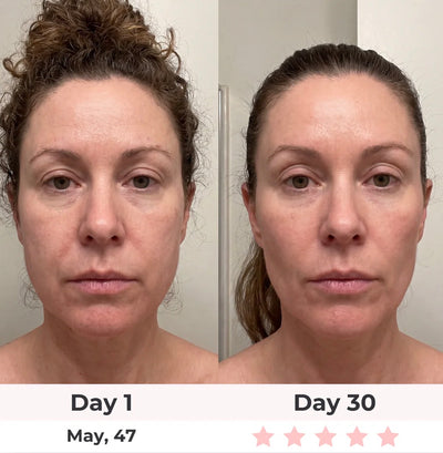 7-in-1 LED Facial Sculptor