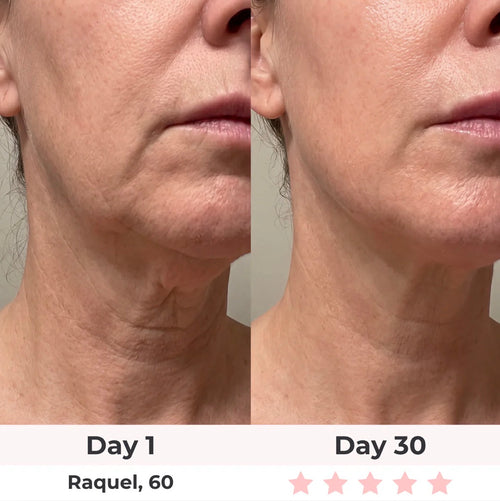 7-in-1 LED Facial Sculptor