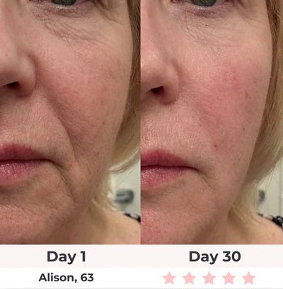 7-in-1 LED Facial Sculptor