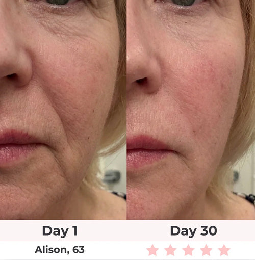 7-in-1 LED Facial Sculptor