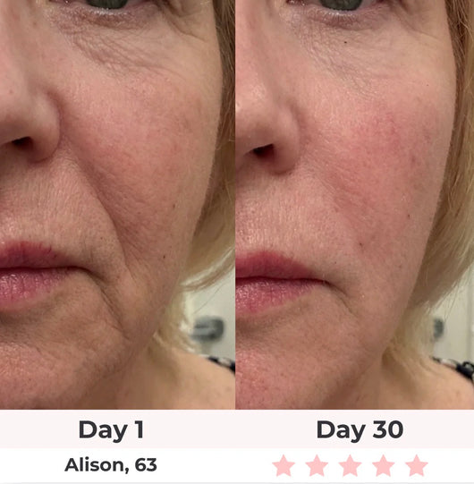 7-in-1 LED Facial Sculptor