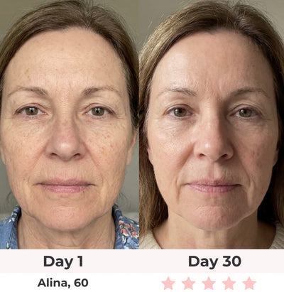Anti-Aging Vitamin C Serum