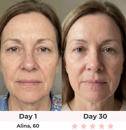 Anti-Aging Vitamin C Serum