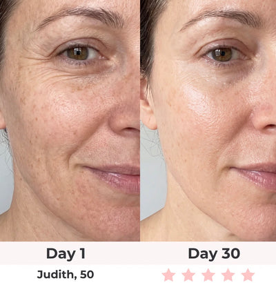 Anti-Aging Vitamin C Serum