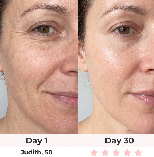 Anti-Aging Vitamin C Serum