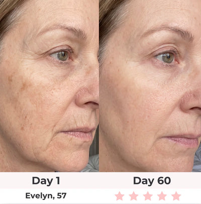 Anti-Aging Vitamin C Serum