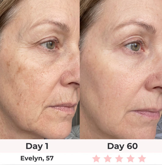 Anti-Aging Vitamin C Serum